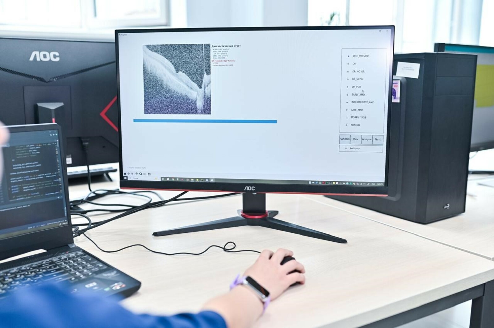 Разработка ученых Межвузовского кампуса Уфы поможет предотвратить потерю зрения